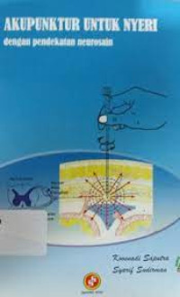 Image of Akupunktur Untuk Nyeri dengan pendekatan neurosain