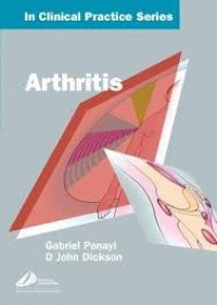 Image of Arthritis