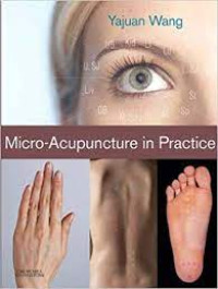 Image of Micro-Acupuncture in Practice