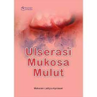 Image of Ulserasi Mukosa Mulut
