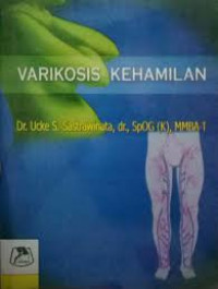 Image of Varikosis Kehamilan